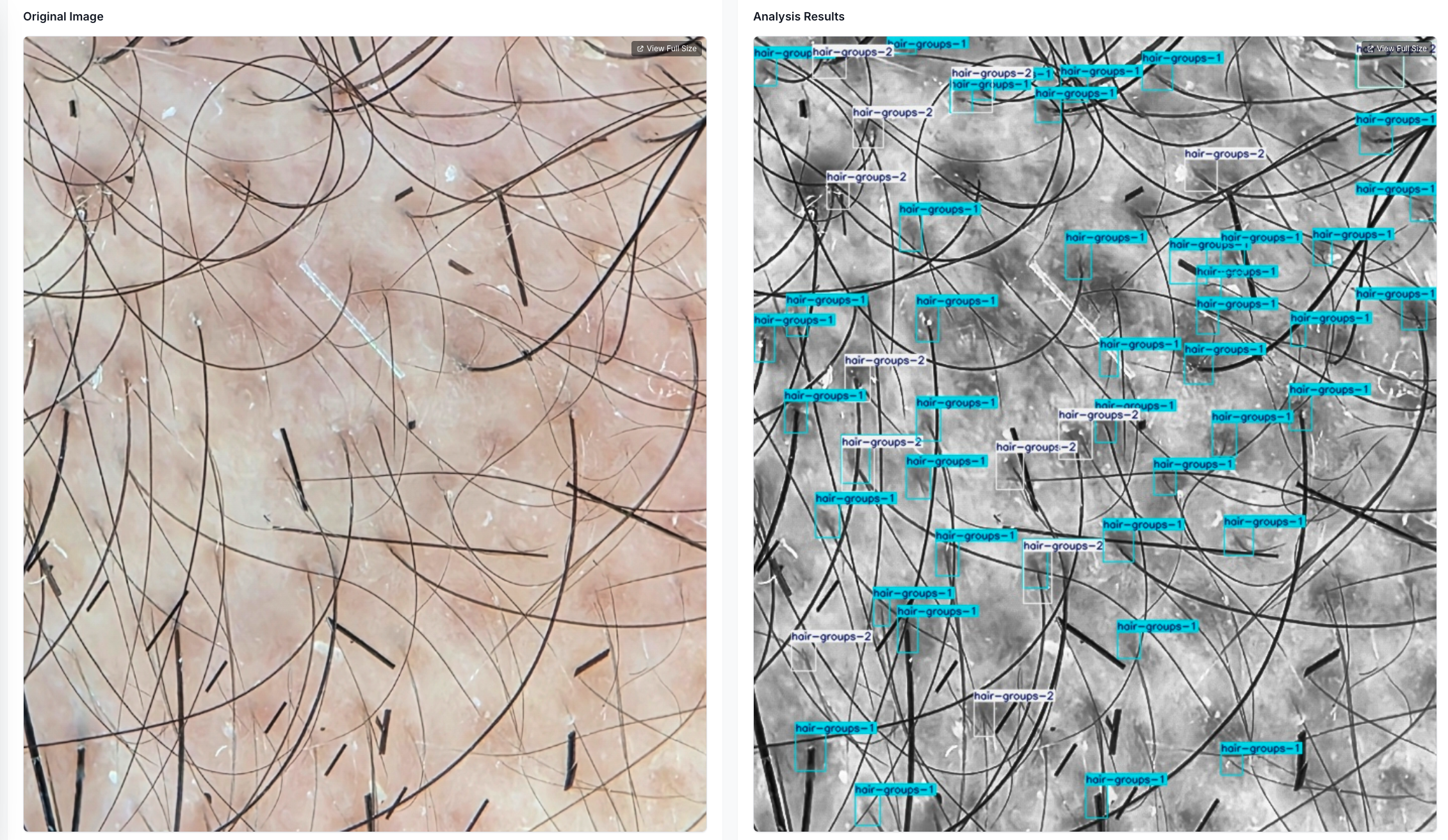 Annotated hair analysis example